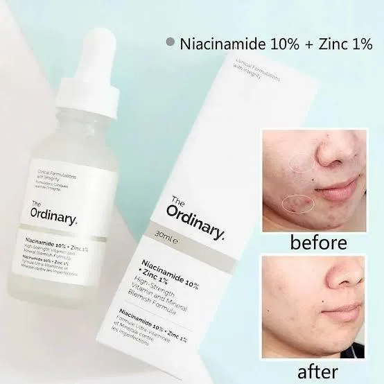 The Ordinary Niacinamide 10% + Zinc 1 %