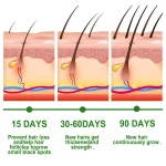 Rosemary Essential Oil for Hair Growth