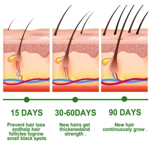 30ml rosemary hair care essential oil anti hair loss growth essential oil hair care nourishing scalp essential oil 4