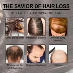 Rosemary Essential Oil for Hair Growth