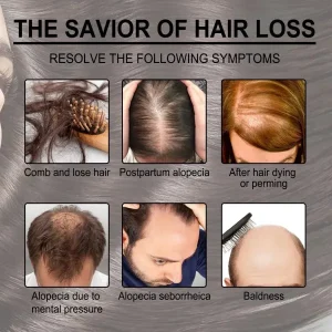 30ml-rosemary-hair-care-essential-oil-anti-hair-loss-growth-essential-oil-hair-care-nourishing-scalp-essential-oil – 5
