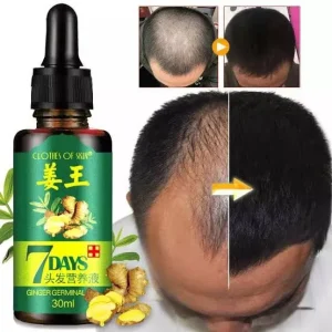 7-days-hair-growth-germinal-serum-oil-30ml – 1