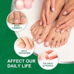 Nail Fungus Treatment Serum 10ml