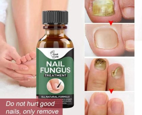 Nail Fungus Treatment Serum 10ml
