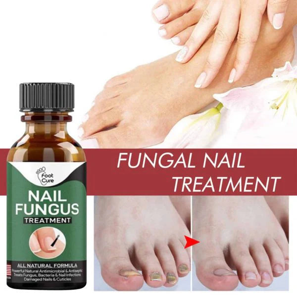 Nail Fungus Treatment Serum 10ml