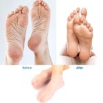 1 Pair Silicone Moisturizing Socks