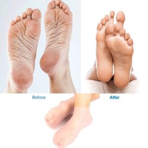 Moisturizing Silicon Socks